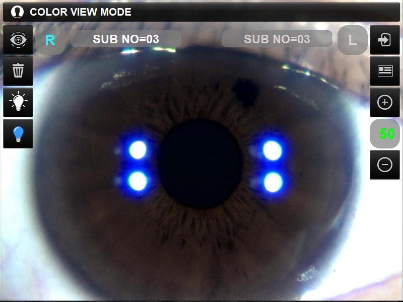 visionmed_measure4.png visionmed_measure4.png