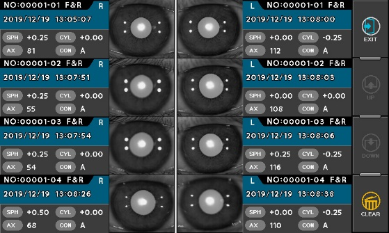 visionmed_measure5.png visionmed_measure5.png