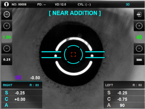 visionmed_near_addition.png visionmed_near_addition.png