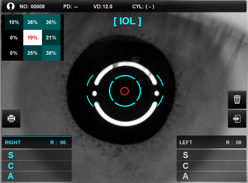 visionmed_measure7.png visionmed_measure7.png