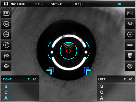 visionmed_semiauto_tracking.png