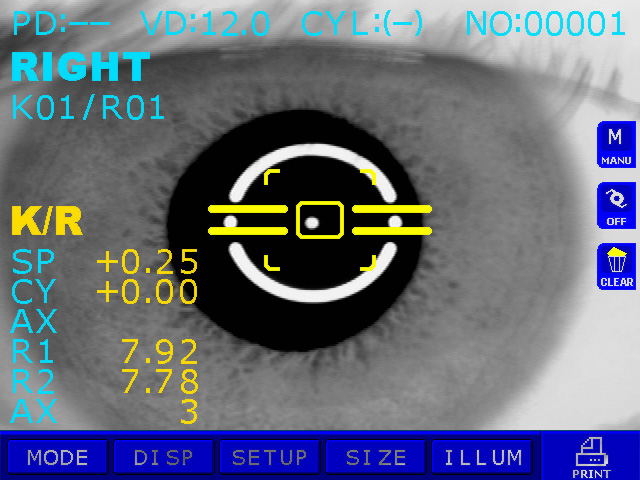 visionmedkz_prk6000_3.jpg.jpg visionmedkz_prk6000_3.jpg.jpg